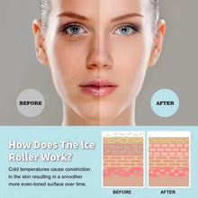 Ice Roller Face Massager